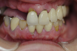 �R�����ȁb�Ǘ�1_befor