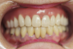 �R�����ȁb�Ǘ�1_after