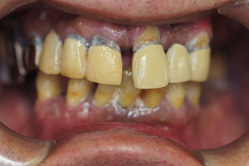 �R�����ȁb�Ǘ�2_befor