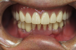 �R�����ȁb�Ǘ�2__after