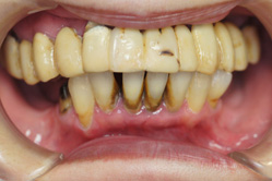 �R�����ȁb�Ǘ�3_befor