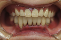 �R�����ȁb�Ǘ�3__after