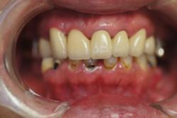 �R�����ȁb�Ǘ�4_befor