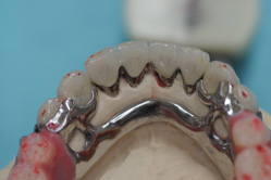 �R�����ȁb�Ǘ�4__after2