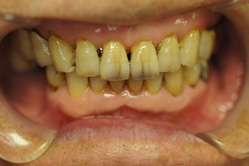 �R�����ȁb�Ǘ�6_befor