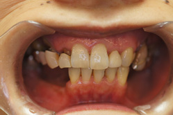 �R�����ȁb�Ǘ�7_befor