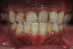 �R�����ȁb�Ǘ�8_befor