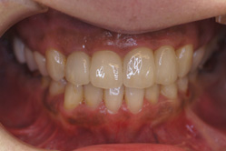 �R�����ȁb�Ǘ�8__after