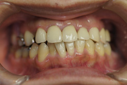 �R�����ȁb�Ǘ�9__after