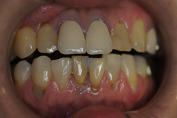 �R�����ȁb�Ǘ�10_befor