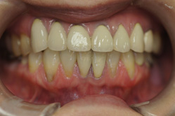 �R�����ȁb�Ǘ�10__after