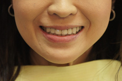 �R�����ȁb�Ǘ�10_after2