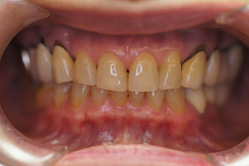 �R�����ȁb�Ǘ�11_befor