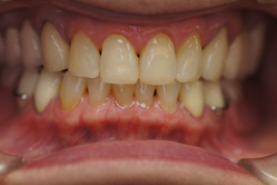 �R�����ȁb�Ǘ�11__after