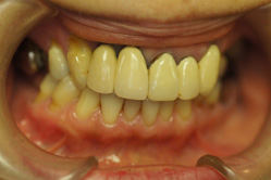 �R�����ȁb�Ǘ�12_befor