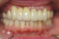 �R�����ȁb�Ǘ�12__after