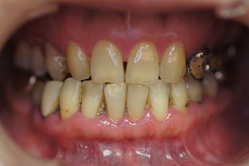 �R�����ȁb�Ǘ�14_befor