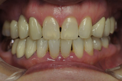 �R�����ȁb�Ǘ�14__after