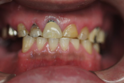 �R�����ȁb�Ǘ�15_befor