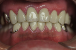 �R�����ȁb�Ǘ�15__after