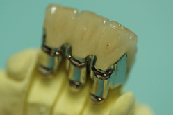 �R�����ȁb�Ǘ�18