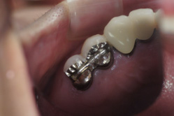 �R�����ȁb�Ǘ�16