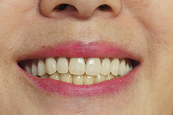 �R�����ȁb�Ǘ�1_after2