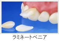 �R�����ȁb���~�l�[�g�׃j�A